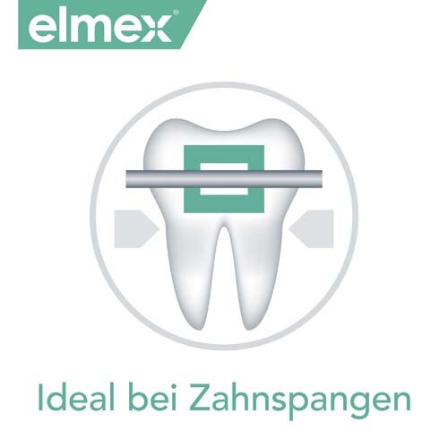 Ideal bei Zahnspangen