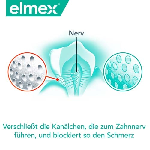 Elmex sensitive professional Mundspülung Vorteil