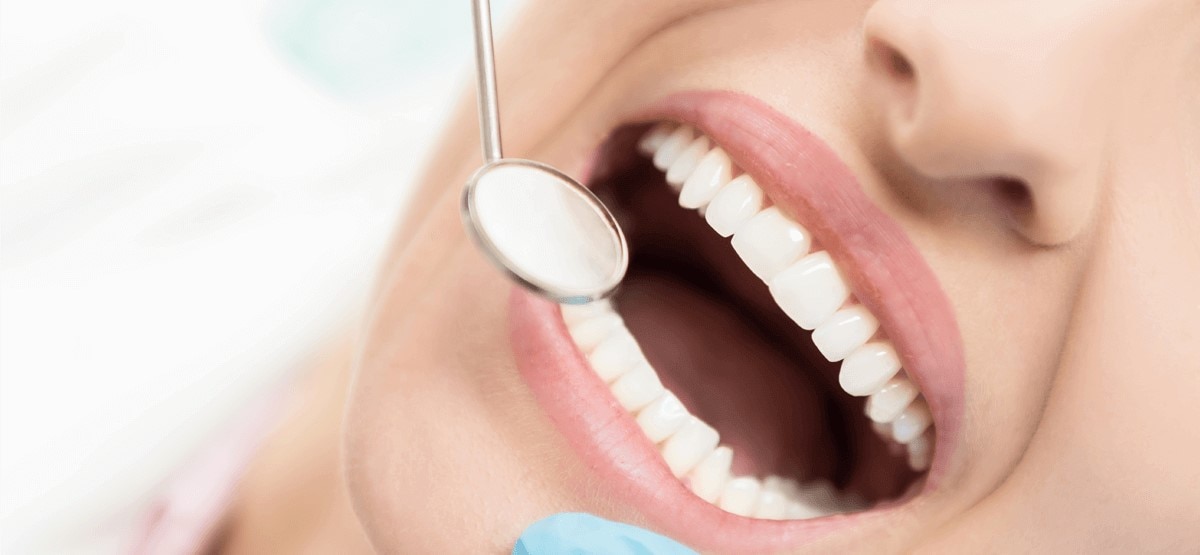 Zahnzwischenraum Karies - Tipps und Behandlung